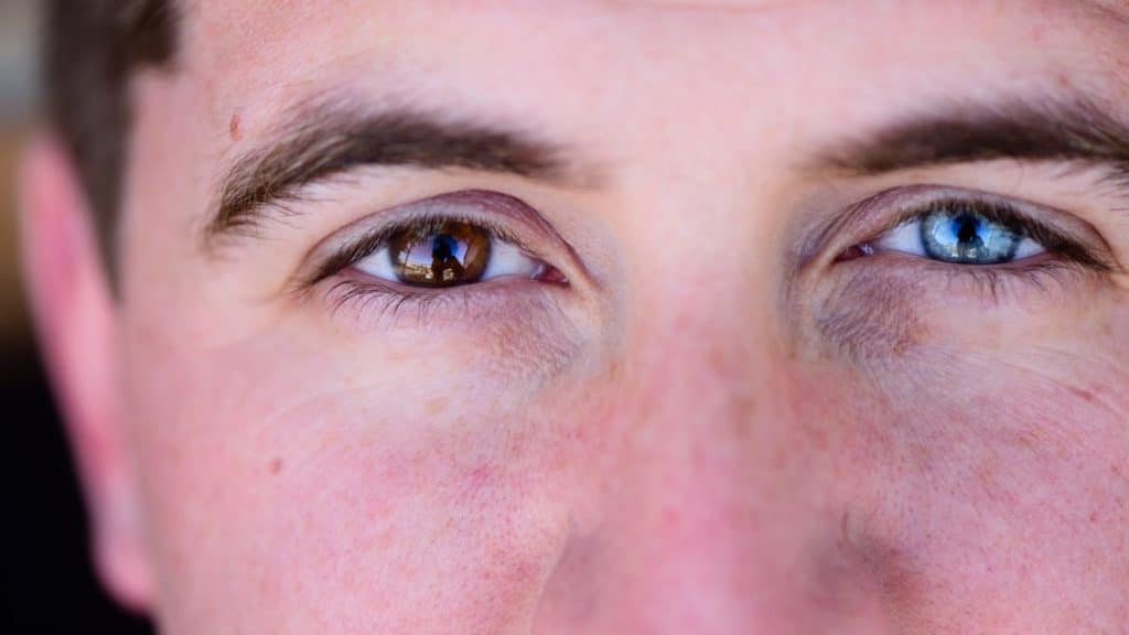 Les yeux les plus rares du monde : ils sont enboûtant
